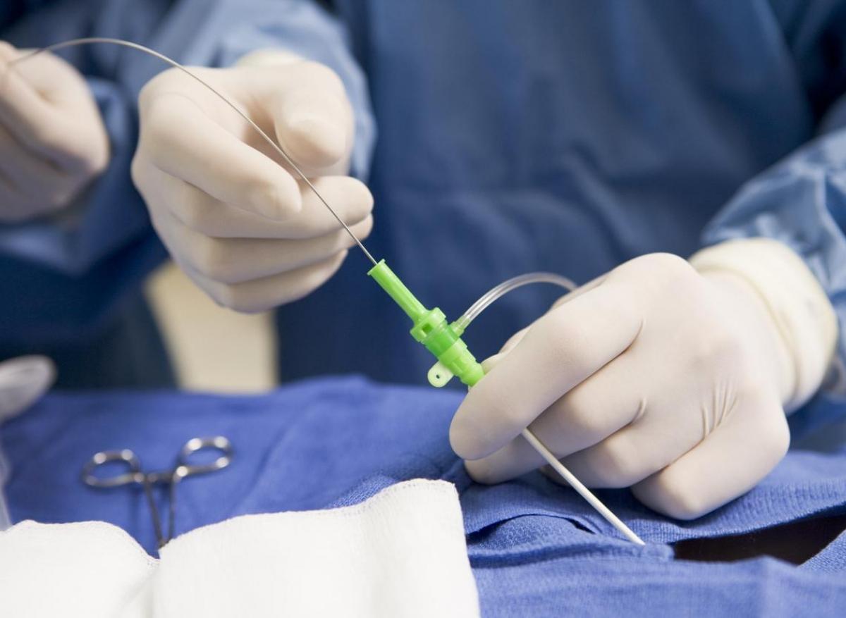 Pose d'un cathéter lors d'une thrombolyse intraveineuse